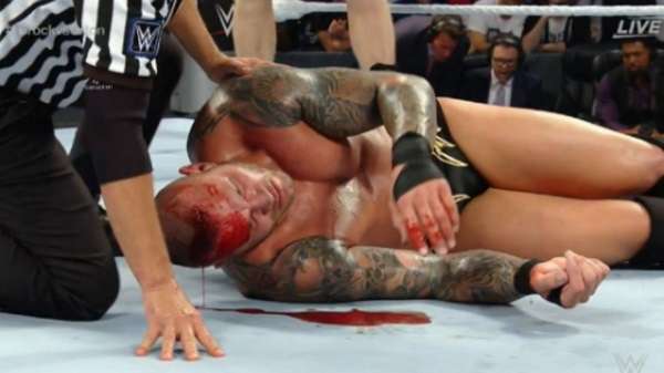 Image result for randy orton injury